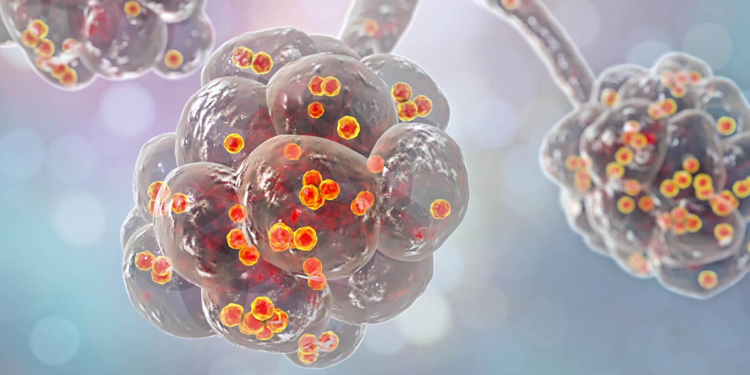 Lebensmittelvergiftung durch Staphylokokken (Staph) - medaVital