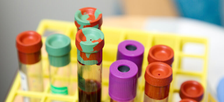 Können Bluttests aus dem Internet den Arztbesuch ersetzen?